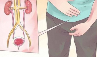 前列腺肥大怎么办 有这样三种治疗方法